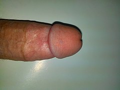 Feloh