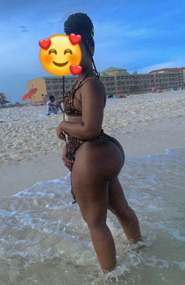 Mercy real pic